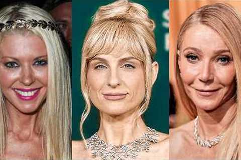 Before and After Photos Of Celebrities With The UGLIEST Ozempic Face