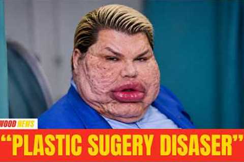 15 Celebrities Before and After Plastic Surgery | Then and Now 2026