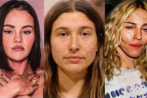 Celebrities Who Permanently RUINED Their Faces For Attention