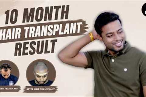Hair Transplant in Jaipur | Trusted Clinic &amp; Cost of Hair Transplant in Jaipur