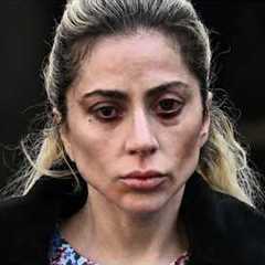 NEW Photos Show Celebrities SUFFERING With Ozempic Eyes