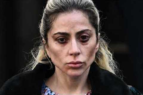 NEW Photos Show Celebrities SUFFERING With Ozempic Eyes